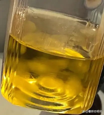 RADII talks about a strange new trend in China where its youth are cultivating and keeping tea leaf fungi mold as pets.