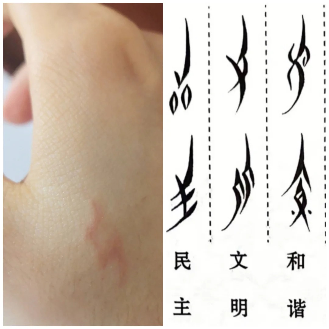 Close-up of skin marked by small punctures forming patterns visually similar to nüshu characters.
